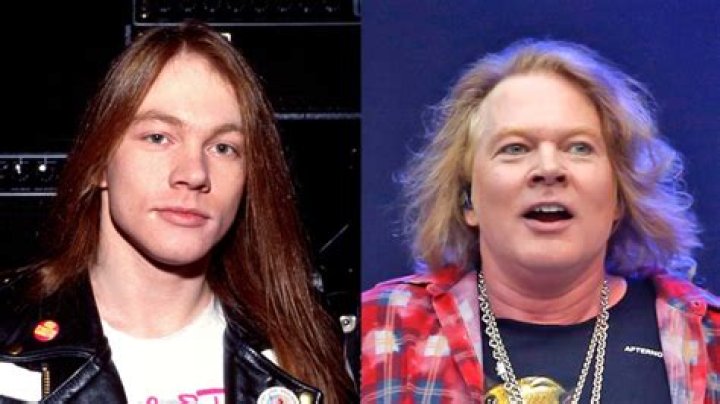 Axl Rose’s Plastic Surgery: The Guns N’ Roses Star Looks Unnatural!