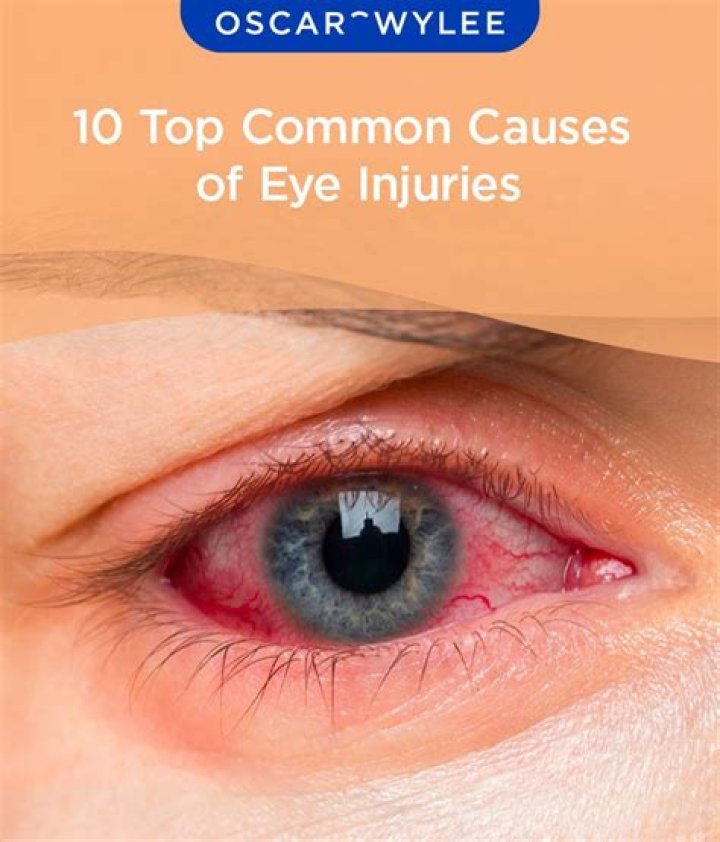 Does Eva Birthistle Have A Glass Eye? Fake News On Eyes Surgery Surface On Internet