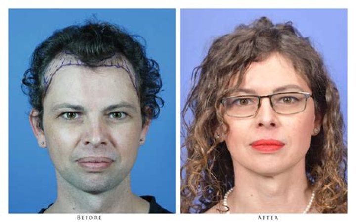 Sasha Allen and Her Transgender Surgery Story, Have A Look At Before and After Transition Pictures